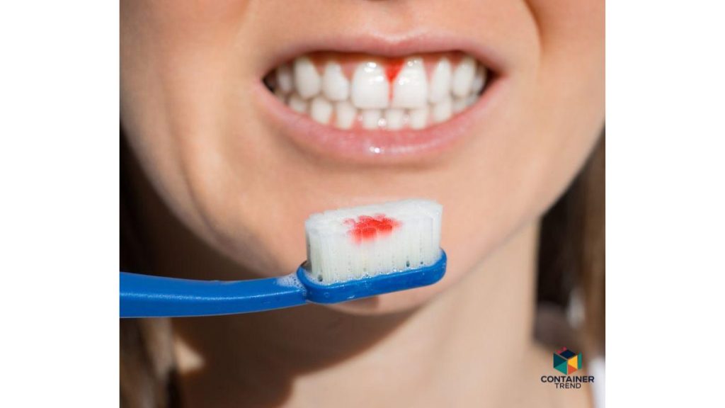 Bleeding-gums-2-1024x576 علاج نزيف اللثة في المنزل وصفات طبيعية مجربة ومضمونة