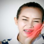 أضرار تقويم الأسنان متى تكون مشكلة؟ وكيف تتجنبها؟