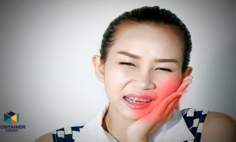 أضرار تقويم الأسنان متى تكون مشكلة؟ وكيف تتجنبها؟